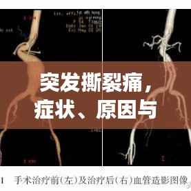 突发撕裂痛,症状、原因与应对方法全解析